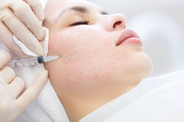 Mesotherapy Nappage Diploma
